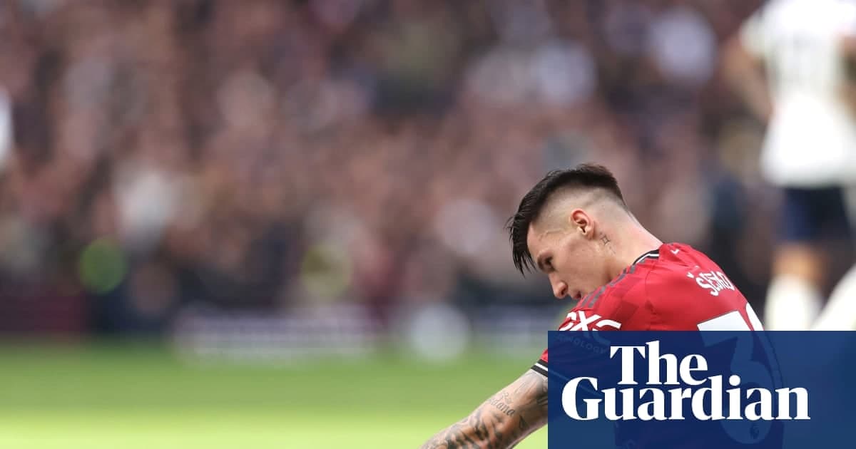 塞斯科膝伤缺阵数周，曼联盼非洲杯前回归