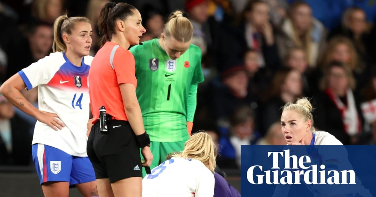 胫骨髁间切迹或成理解女子足球ACL高发的关键线索